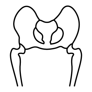 Greater Q-Angle